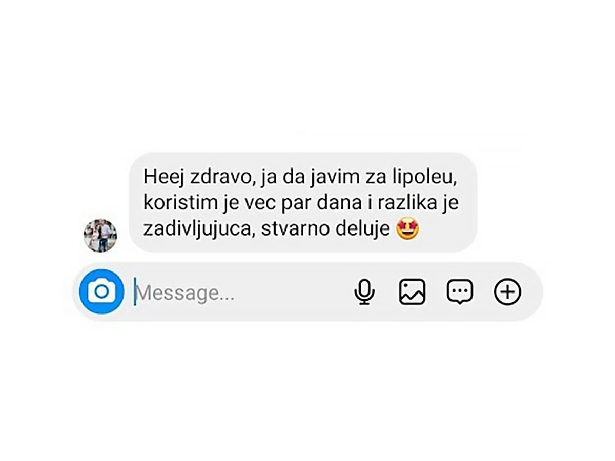 lipolea iskustvo